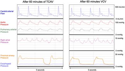 Time-Controlled Adaptive Ventilation Does Not Induce Hemodynamic Impairment in a Swine ARDS Model